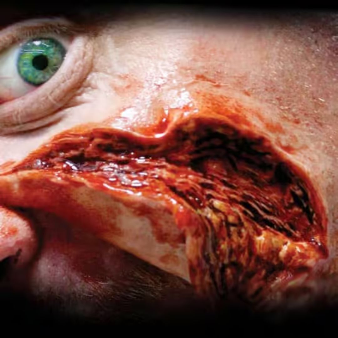 Tinsley Transfers Gouged 3D FX Transfer aangebracht, verkrijgbaar bij SchminkenGrime.nl Tinsley Transfers Gouged 3D FX Transfer op huid aangebracht, realistische wondprothese voor SFX make-up, verkrijgbaar bij SchminkenGrime.nl
