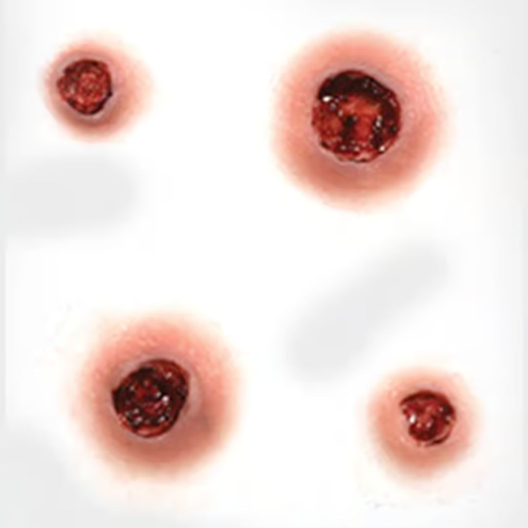 Close-up Tinsley Transfers Capped 3D FX Transfer – vier hyperrealistische schotwonden protheses – SchminkenGrime.nl