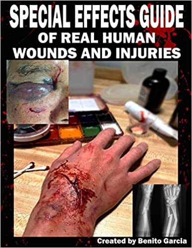 Special Effects Guide of Real Human Wounds and Injuries