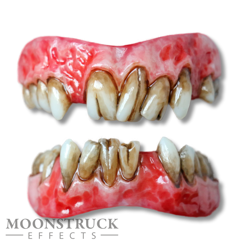 Moonstruck Effects Lazarus gebitsprothese met ontstoken tandvlees, rotte tanden, scheuren en ontbrekende kiezen, realistisch SFX-gebit voor film, horror en grime, verkrijgbaar bij SchminkenGrime.nl